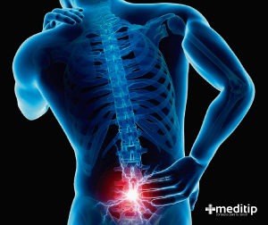 Lumbalgia o dolor de espalda
