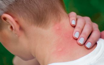 Tratamiento de la chikungunya: prevención, piquete de mosquito