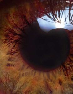 ojo con glaucoma