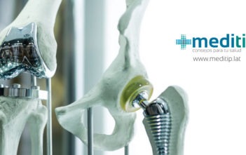 Prótesis de rodilla