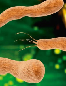 H. pylori , causa de la gastritis , úlcera