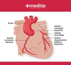 Arterias coronarias