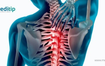 causas del dolor de espalda