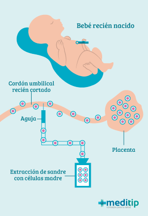 Extracción de células madre