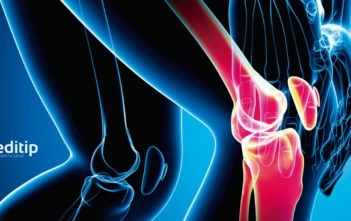 Tipos de artritis: osteoartritis