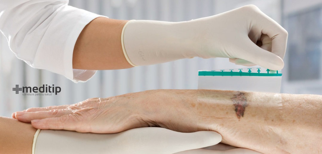 Apósitos para heridas: tipos e indicaciones - Meditip
