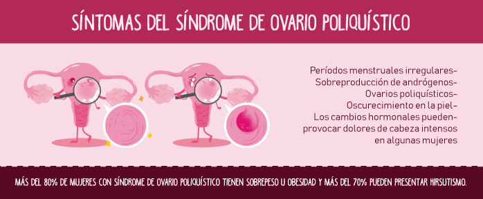Síntomas del síndrome de ovario poliquístico