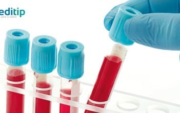 Prueba de perfil tiroideo