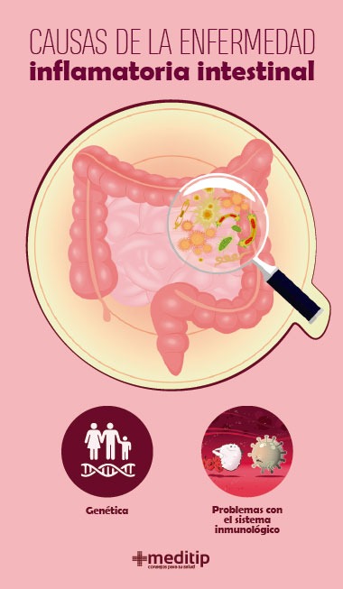 Causas de la enfermedad inflamatoria intestinal