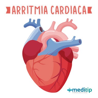 Arritmia cardiaca