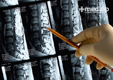 Diagnóstico de hernia de disco: resonancia magnética