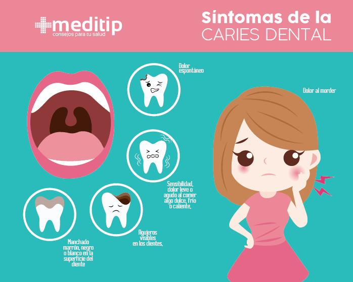 Síntomas de la caries dental