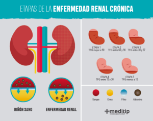 Enfermedad renal crónica: causas, diagnóstico y tratamiento