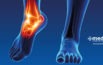 Dolor de tobillo