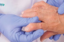 Tipos de artritis: factor reumatoide