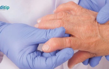 Tipos de artritis: factor reumatoide