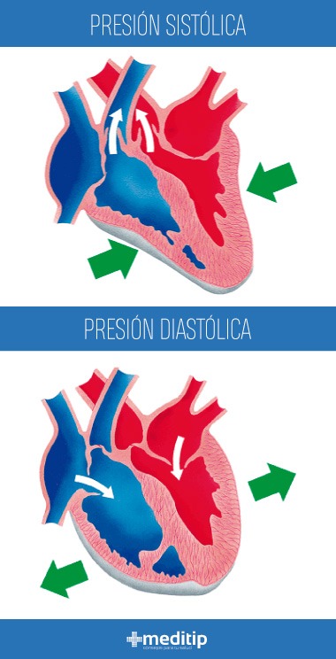 Presión arterial baja: presión sistólica y presión diastólica