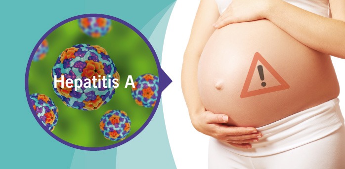 contagio de hepatitis A: embarazo