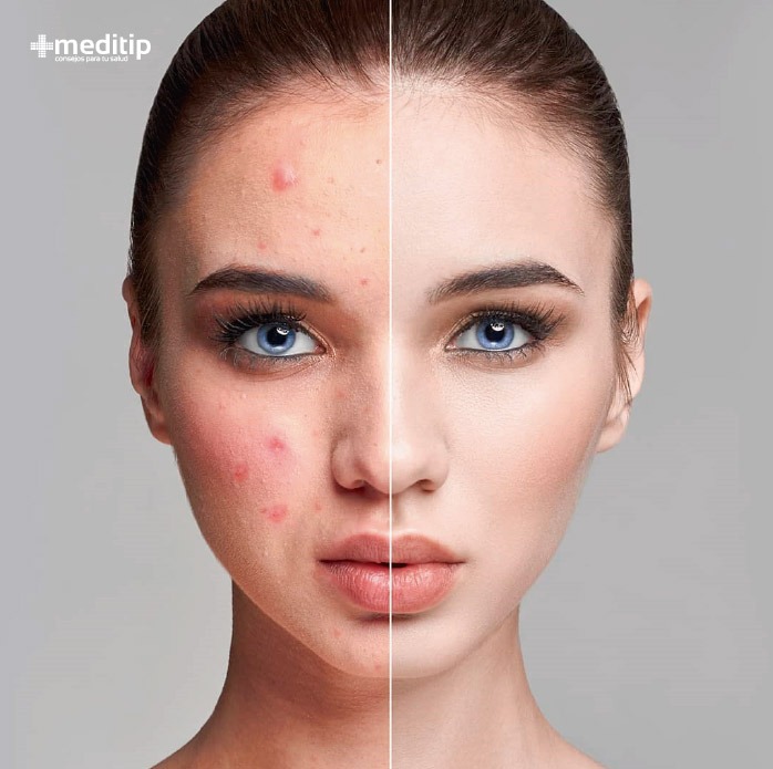 Salud de la piel: piel enferma y piel saludable