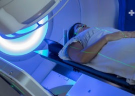 Función de la radioterapia y sus efectos secundarios