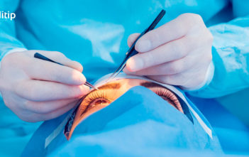 Complicaciones del glaucoma: trabeculectomía