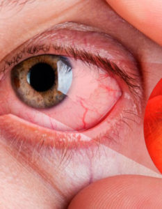 Enfermedad ocular por diabetes: qué es la retinopatía diabética