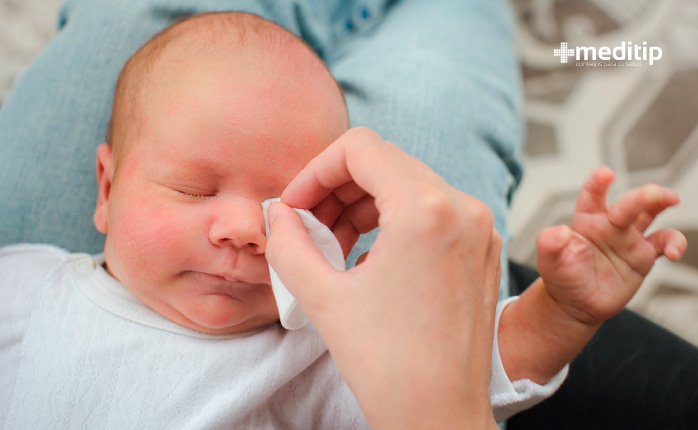Epífora en bebés: cómo limpiar los ojos llorosos de los bebés