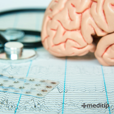 Diagnóstico de la epilepsia: electrodo y ondas cerebrales
