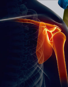 Remedios para el dolor de huesos y articulaciones: alimentación para fortalecer los huesos y las articulaciones