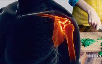 Remedios para el dolor de huesos y articulaciones: alimentación para fortalecer los huesos y las articulaciones