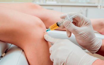 Que es una infiltración intraarticular: inyecciones para el alivio del dolor de articulaciones