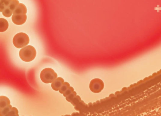 La resistencia antimicrobiana en tiempos de pandemia: crisis mundial desatendida que requiere atención urgente
