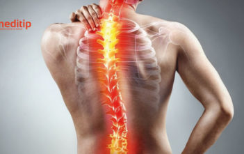 Desviación de la columna: curvatura anormal de la columna