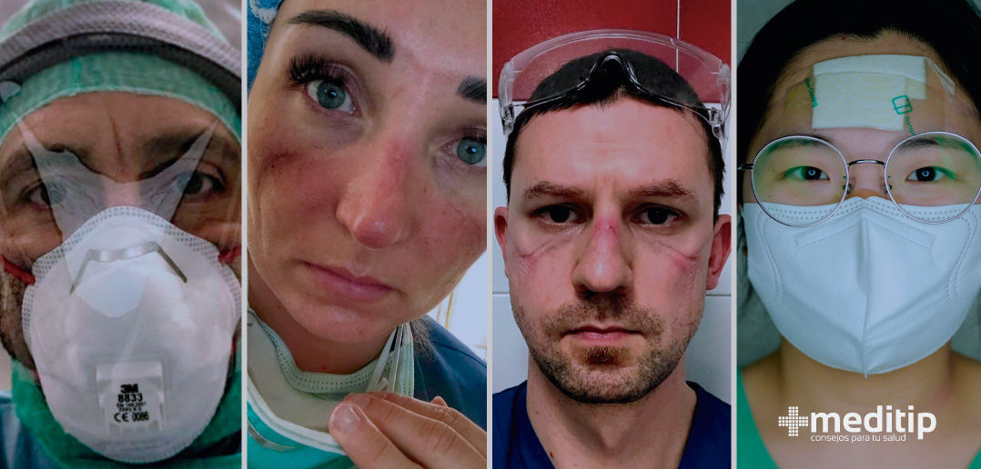 Heridas por uso de equipo de protección sanitaria: Lesiones faciales en profesionales de la salud