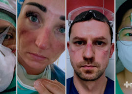 Heridas por uso de equipo de protección sanitaria: lesiones faciales en profesionales de la salud