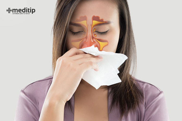 Terapia para tratar síntomas de la rinitis, sinusitis y rinosinusitis: lavado nasal