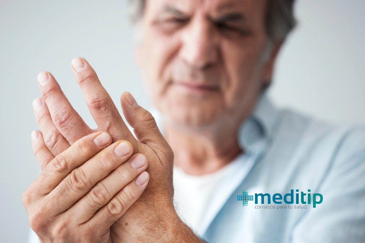 Qué es la artritis - Síntomas y tratamiento
