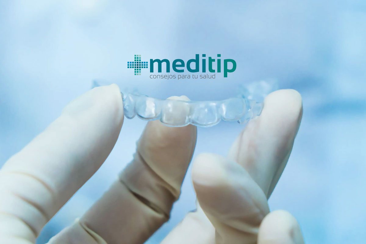 En la mayoría de las veces, el tratamiento con alineadores es tan eficaz para enderezar los dientes como los aparatos tradicionales de metal.