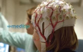 Epilepsia intratable en niños