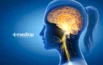 Qué es la estimulación del nervio vago en la epilepsia