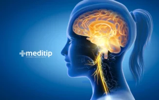 Qué es la estimulación del nervio vago en la epilepsia