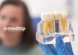 Beneficios Estéticos y Funcionales de los Implantes Dentales