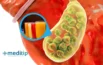 Piedras en la Vesícula: Alimentos y Bebidas para Eliminarlas y Prevenirlas