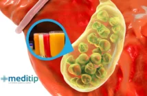 Piedras en la Vesícula: Alimentos y Bebidas para Eliminarlas y Prevenirlas