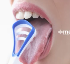 Beneficios de la Limpieza de la Lengua: Qué es el Raspado de la Lengua