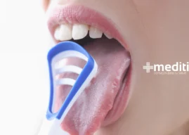 Beneficios de la Limpieza de la Lengua: Qué es el Raspado de la Lengua